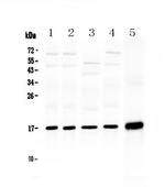 HSP20 Antibody in Western Blot (WB)