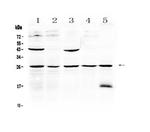 Noggin Antibody in Western Blot (WB)