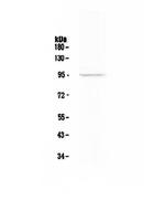 FAP Antibody in Western Blot (WB)