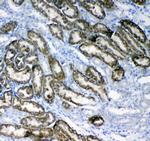 Glycerol kinase Antibody in Immunohistochemistry (Paraffin) (IHC (P))