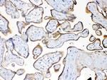 MUC1 Antibody in Immunohistochemistry (Paraffin) (IHC (P))