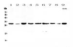 14-3-3 sigma Antibody in Western Blot (WB)