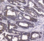 MRE11 Antibody in Immunohistochemistry (Paraffin) (IHC (P))