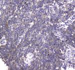 MRE11 Antibody in Immunohistochemistry (Paraffin) (IHC (P))