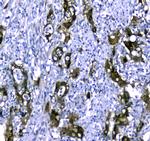 STUB1 Antibody in Immunohistochemistry (Paraffin) (IHC (P))