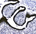 STUB1 Antibody in Immunohistochemistry (Paraffin) (IHC (P))