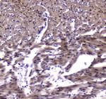 ESRRG Antibody in Immunohistochemistry (Paraffin) (IHC (P))