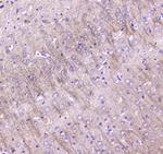 LC3A Antibody in Immunohistochemistry (Paraffin) (IHC (P))