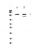 SHIP1 Antibody in Western Blot (WB)