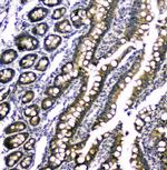 RAB6A Antibody in Immunohistochemistry (Paraffin) (IHC (P))