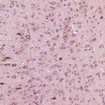 Calcitonin Antibody in Immunohistochemistry (Paraffin) (IHC (P))