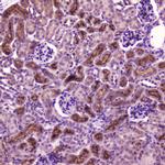 PDGFRB Antibody in Immunohistochemistry (Paraffin) (IHC (P))