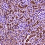 PDGFRB Antibody in Immunohistochemistry (Paraffin) (IHC (P))