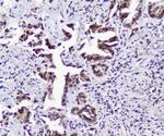 TPR Antibody in Immunohistochemistry (Paraffin) (IHC (P))