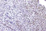 TPR Antibody in Immunohistochemistry (Paraffin) (IHC (P))