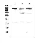 TPR Antibody in Western Blot (WB)