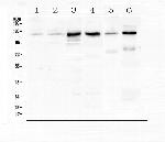 P-cadherin Antibody in Western Blot (WB)