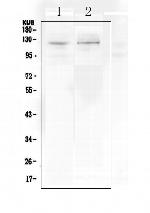 DDR2 Antibody in Western Blot (WB)