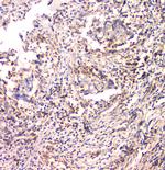 IFN gamma Antibody in Immunohistochemistry (Paraffin) (IHC (P))