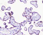 LATS1 Antibody in Immunohistochemistry (Paraffin) (IHC (P))