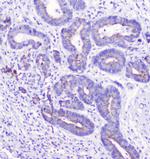 LATS1 Antibody in Immunohistochemistry (Paraffin) (IHC (P))