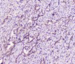 LATS1 Antibody in Immunohistochemistry (Paraffin) (IHC (P))