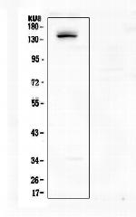 LATS1 Antibody in Western Blot (WB)