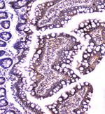 TANK Antibody in Immunohistochemistry (Paraffin) (IHC (P))