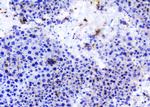 TANK Antibody in Immunohistochemistry (Paraffin) (IHC (P))