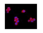 TRPM7 Antibody in Immunocytochemistry (ICC/IF)