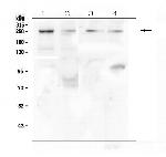 TRPM7 Antibody in Western Blot (WB)