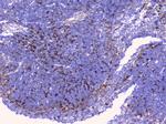 BTLA Antibody in Immunohistochemistry (Paraffin) (IHC (P))