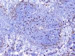 BTLA Antibody in Immunohistochemistry (Paraffin) (IHC (P))