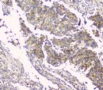 HAS1 Antibody in Immunohistochemistry (Paraffin) (IHC (P))