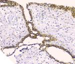 HAS1 Antibody in Immunohistochemistry (Paraffin) (IHC (P))