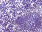 HAS1 Antibody in Immunohistochemistry (Paraffin) (IHC (P))