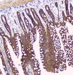 HAS1 Antibody in Immunohistochemistry (Paraffin) (IHC (P))