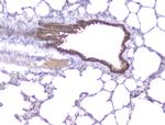 PKC beta-1 Antibody in Immunohistochemistry (Paraffin) (IHC (P))