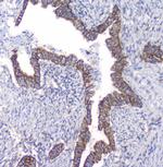 PKC beta-1 Antibody in Immunohistochemistry (Paraffin) (IHC (P))