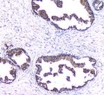 PKC beta-1 Antibody in Immunohistochemistry (Paraffin) (IHC (P))