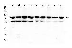 PKC beta-1 Antibody in Western Blot (WB)