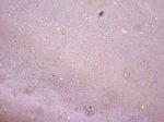 PKC gamma Antibody in Immunohistochemistry (Paraffin) (IHC (P))