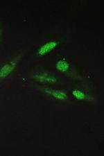 Sorcin Antibody in Immunocytochemistry (ICC/IF)