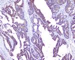 Sorcin Antibody in Immunohistochemistry (Paraffin) (IHC (P))