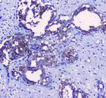 Sorcin Antibody in Immunohistochemistry (Paraffin) (IHC (P))