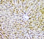 AKR1D1 Antibody in Immunohistochemistry (Paraffin) (IHC (P))