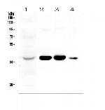 AKR1D1 Antibody in Western Blot (WB)