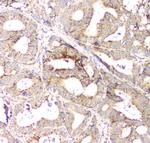 APRT Antibody in Immunohistochemistry (Paraffin) (IHC (P))