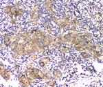 APRT Antibody in Immunohistochemistry (Paraffin) (IHC (P))