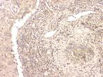 BMP-15 Antibody in Immunohistochemistry (Paraffin) (IHC (P))